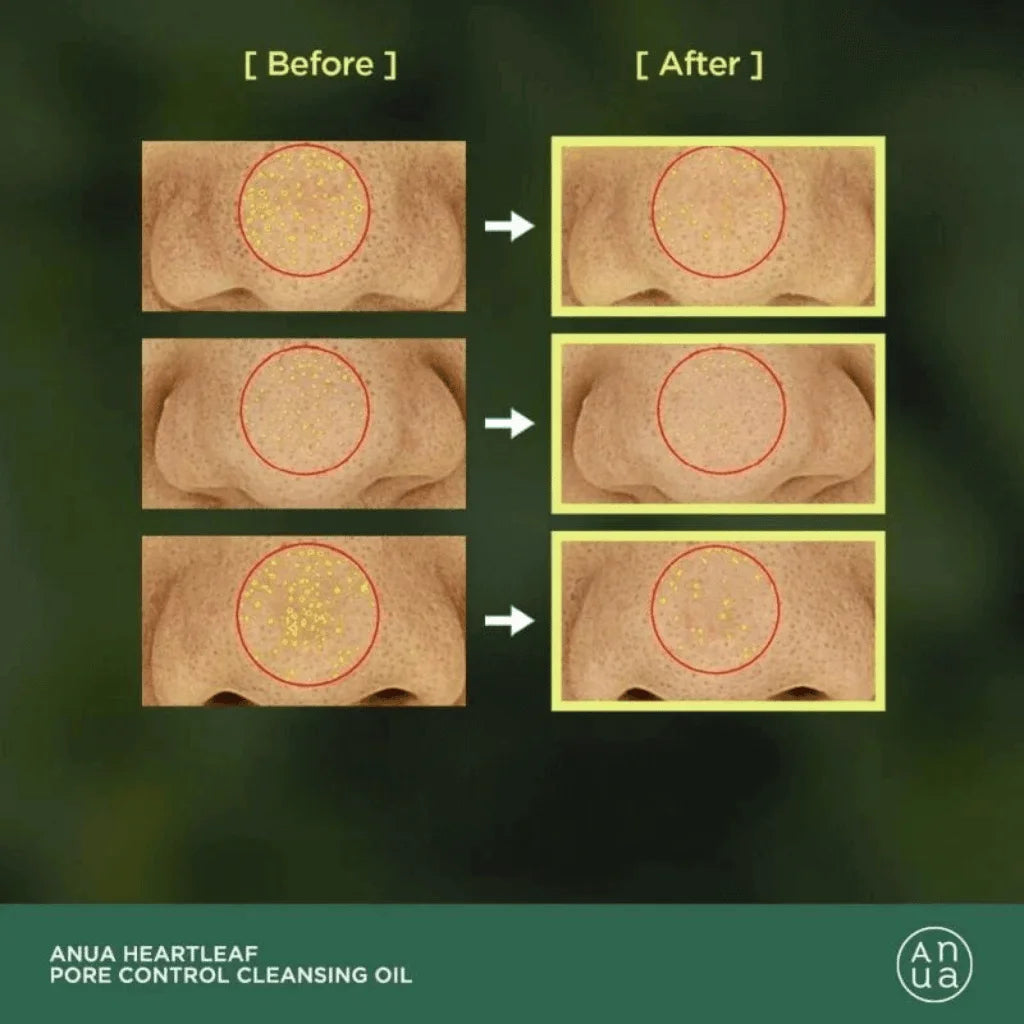 ANUA Heartleaf Pore Control Cleansing Oil 200ml