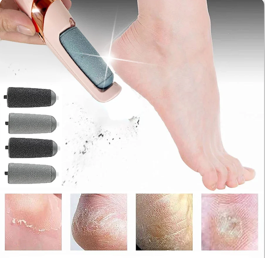 Soft Feet – Rimuovi Calli e Screpolature dei Piedi