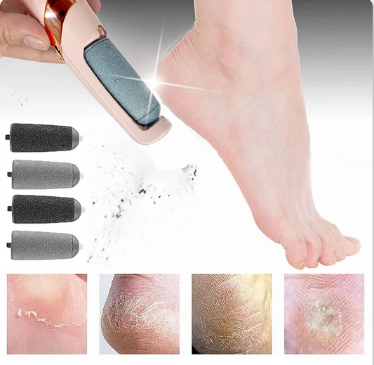 Soft Feet – Rimuovi Calli e Screpolature dei Piedi