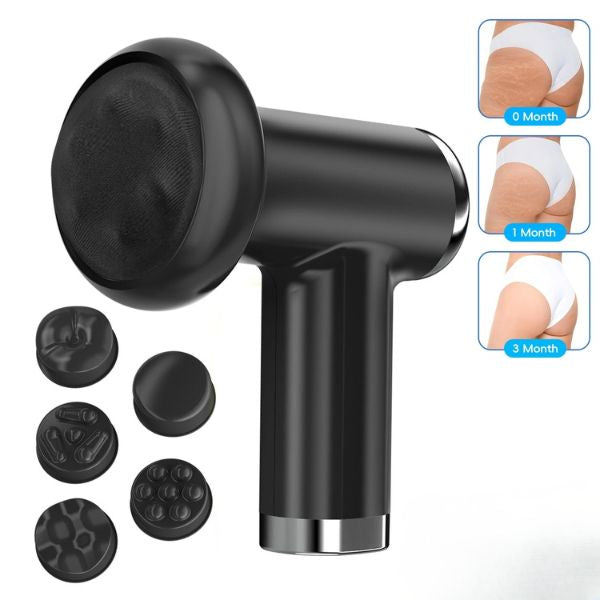 Body Sculpt Pro – Massaggiatore Rimodellante Anticellulite