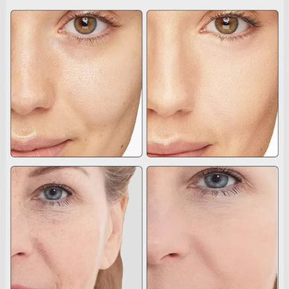 Age Booster Pro – Dispositivo Viso Anti-Età a LED 7 Colori