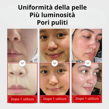 MEDICUBE Age-R Booster Pro Nero